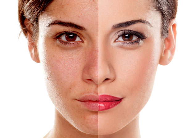 Expert Tips for Minimizing Aging Spots