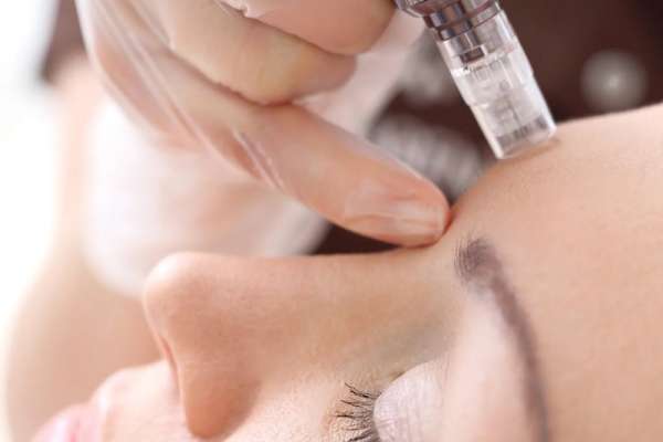 Hyaluronic Acid - Microneedling