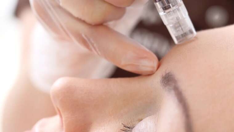Hyaluronic Acid