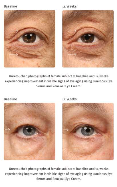 EPIONCE-RENEWAL EYE CREAM ($78) - Image 2