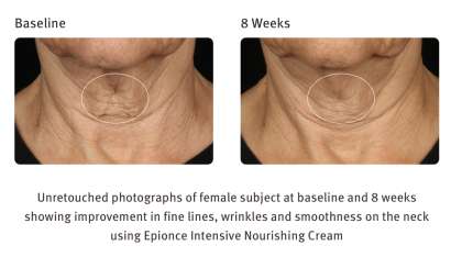 EPIONCE INTENSIVE NOURISHING CREAM ($120) - Image 2