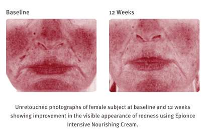 EPIONCE INTENSIVE NOURISHING CREAM ($120) - Image 3
