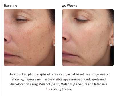 EPIONCE INTENSIVE NOURISHING CREAM ($120) - Image 4