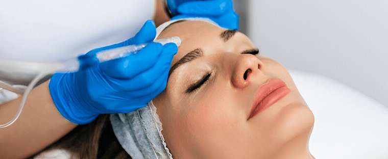 PRP Microneedling Treatment for Acne Scars & Anti-Aging