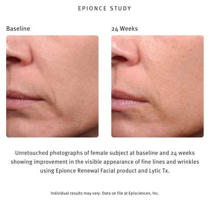 EPIONCE RENEWAL FACIAL LOTION ($102) - Image 2