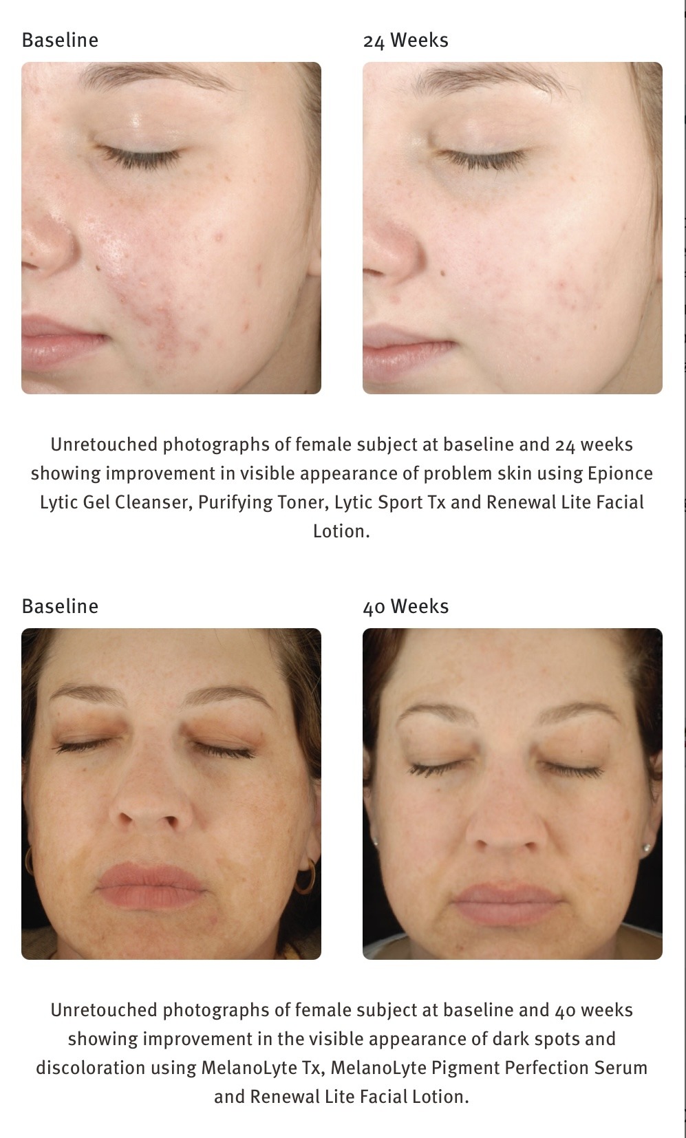 EPIONCE RENEWAL LITE FACIAL LOTION ($102) - Image 2