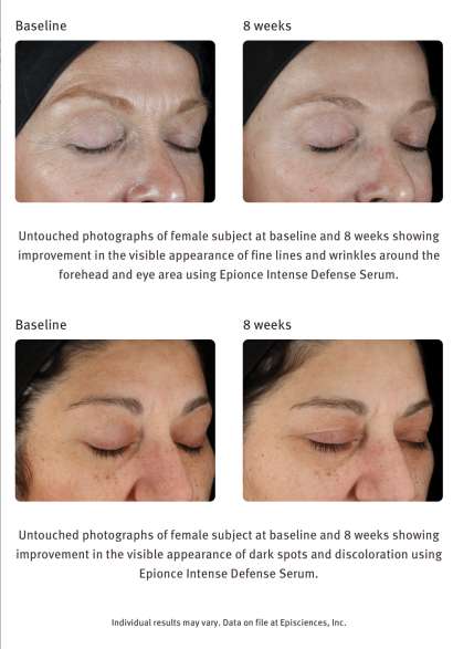 EPIONCE INTENSE DEFENSE SERUM ($150) - Image 2
