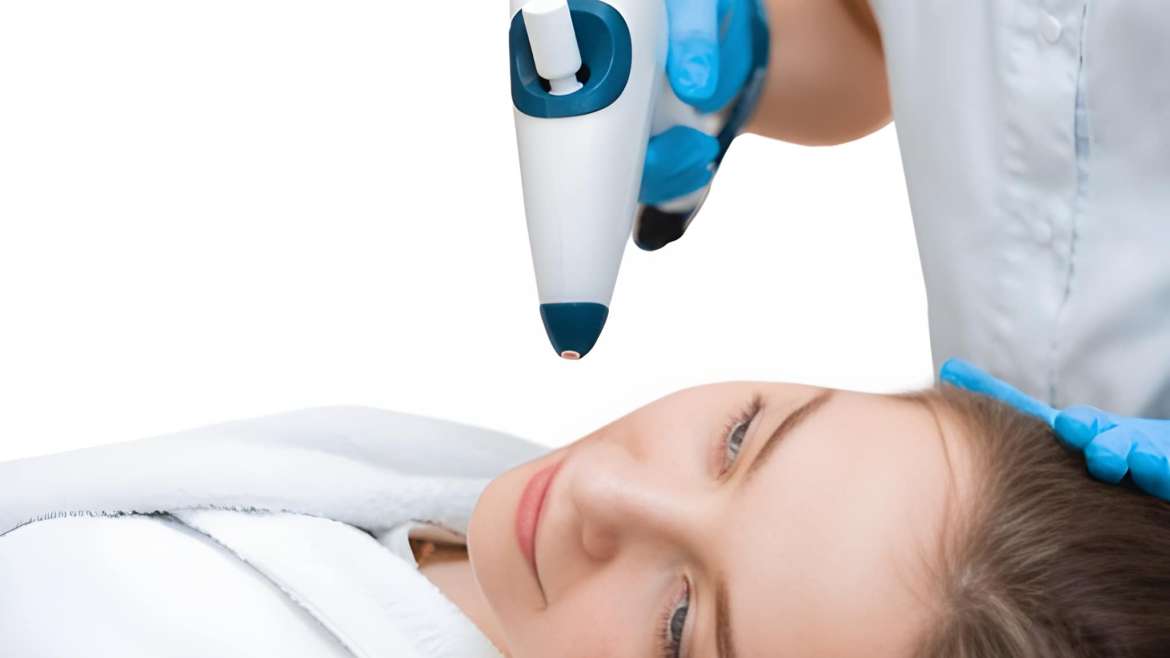 Cryopen Precision Cryotherapy