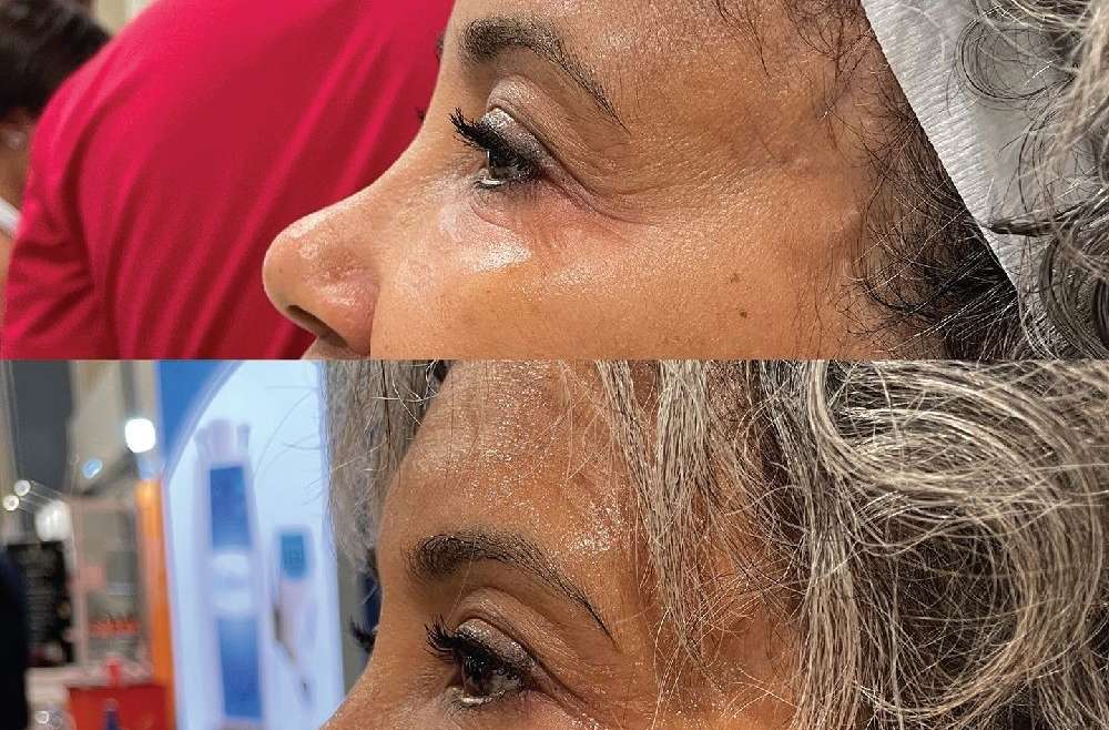 Rejuvenate MD – Advanced Anti-Aging Treatment