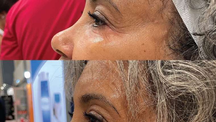Rejuvenate MD – Advanced Anti-Aging Treatment