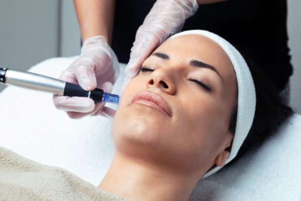 Stem Cell - Exosomes Microneedling in Kirkland, WA - Templum Aesthetics & Wellness