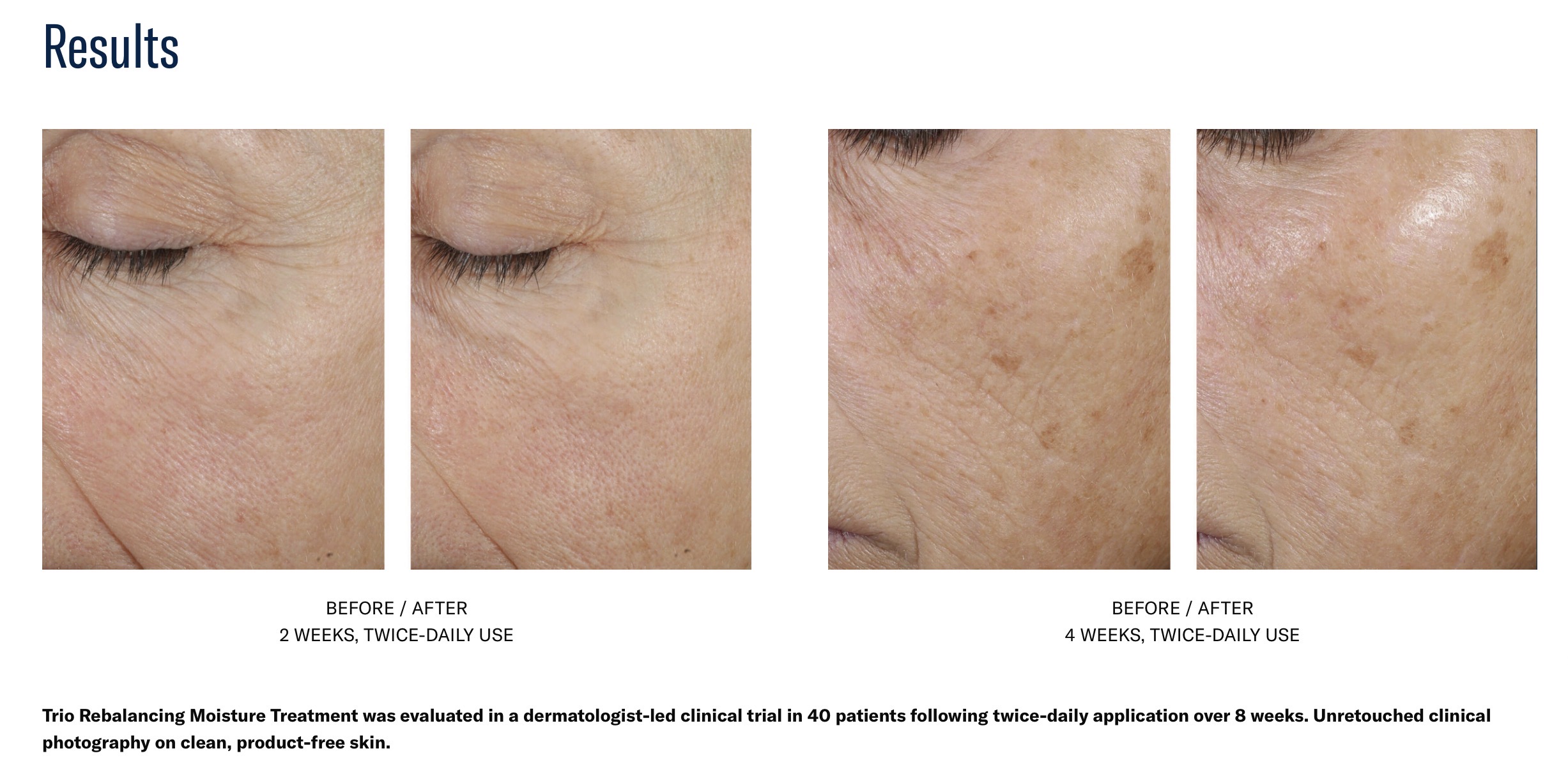 SKIN BETTER SCIENCE TRIO REBALANCING MOISTURE TREATMENT - Image 2