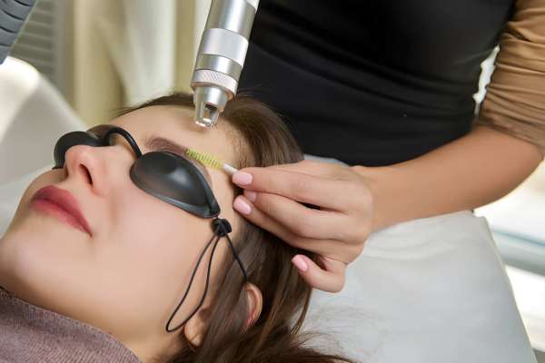 Renew CO2 Laser Resurfacing Renew CO2 Laser Resurfacing