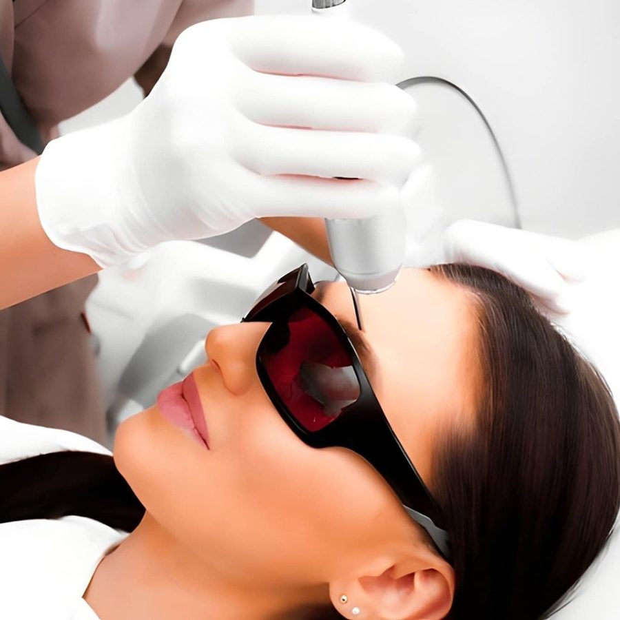 MicroLaser Peel at Templum Aesthetics & Wellness